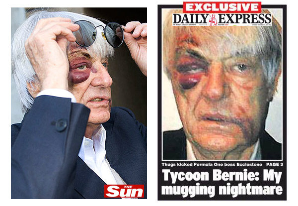 Ecclestone muestra su cara destrozada tras el atraco en Londres